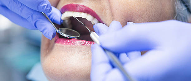 Best Broken or Chipped Tooth Repair in Philomath, OR
